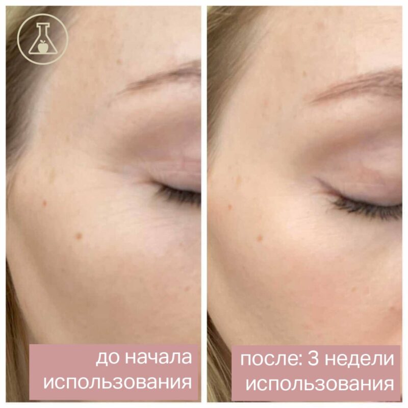 Крем для век